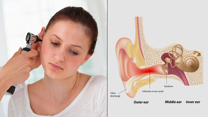 Adult Ear Infections: Types, Treatments and Preventive ...