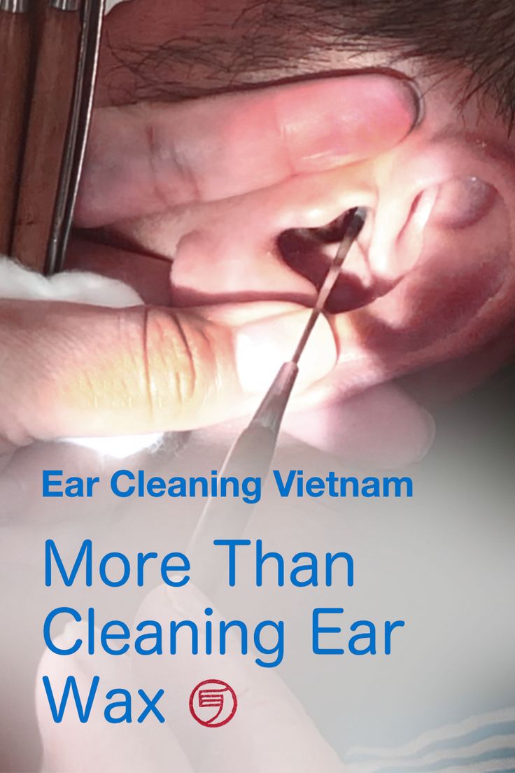 Besides removing ear wax, Vietnamese ear cleaning includes trimming ear ...