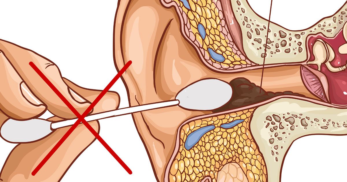 Better methods for cleaning out earwax