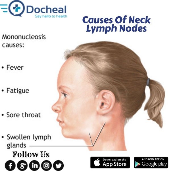 Can a common cold cause neck lymph nodes?