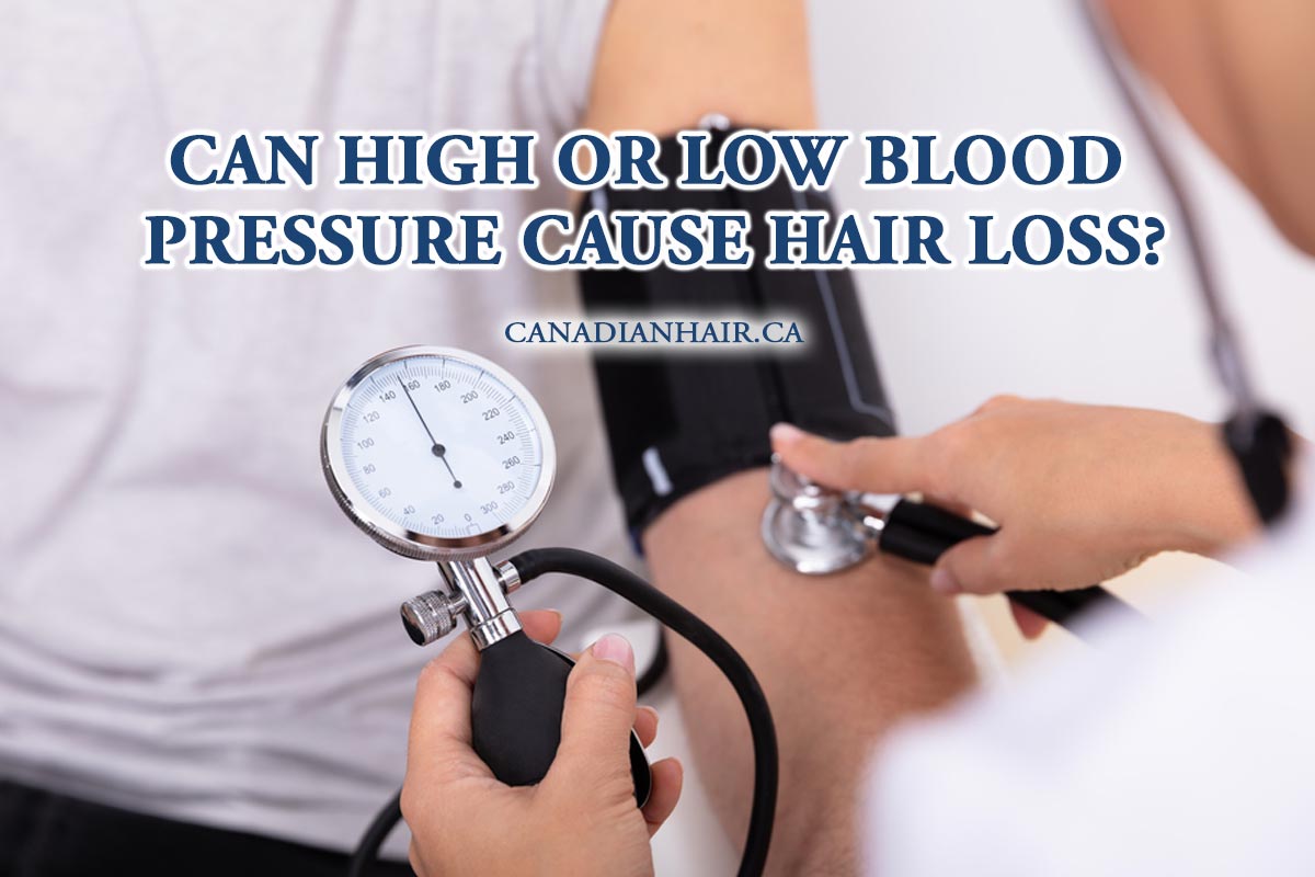 Can High or Low Blood Pressure Cause Hair Loss?