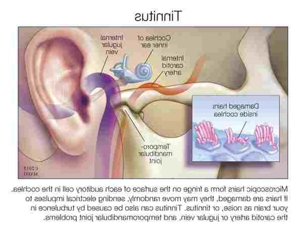 Can Tinnitus Be Inherited Infection Ear Give Headaches ...