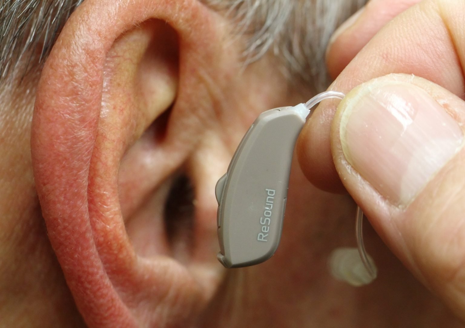 Can You Get Disability For Hearing Loss