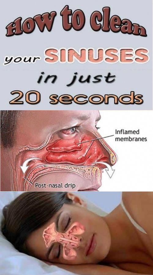 DIY How to Clear Your Sinuses in Seconds Using Nothing But ...