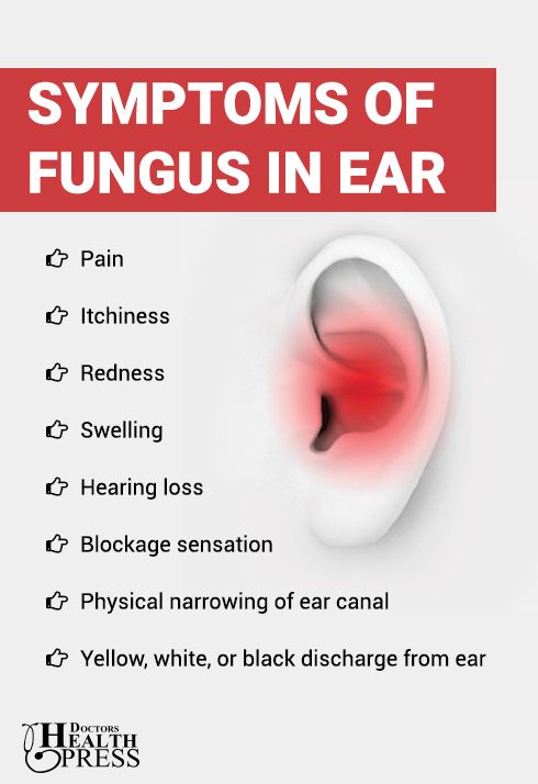 Ear Fungus (Otomycosis) Causes Symptoms Treatments ...