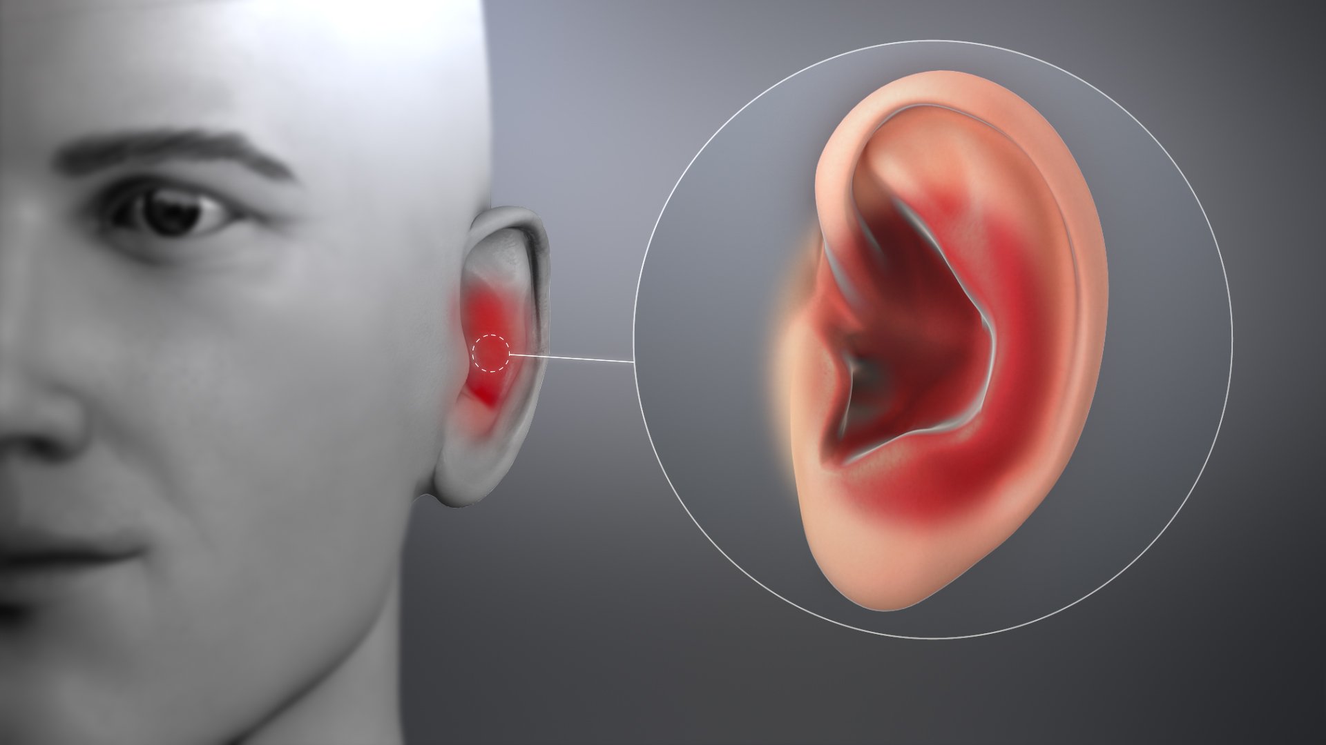 Ear Infection: Symptoms, Causes, and Treatment ...