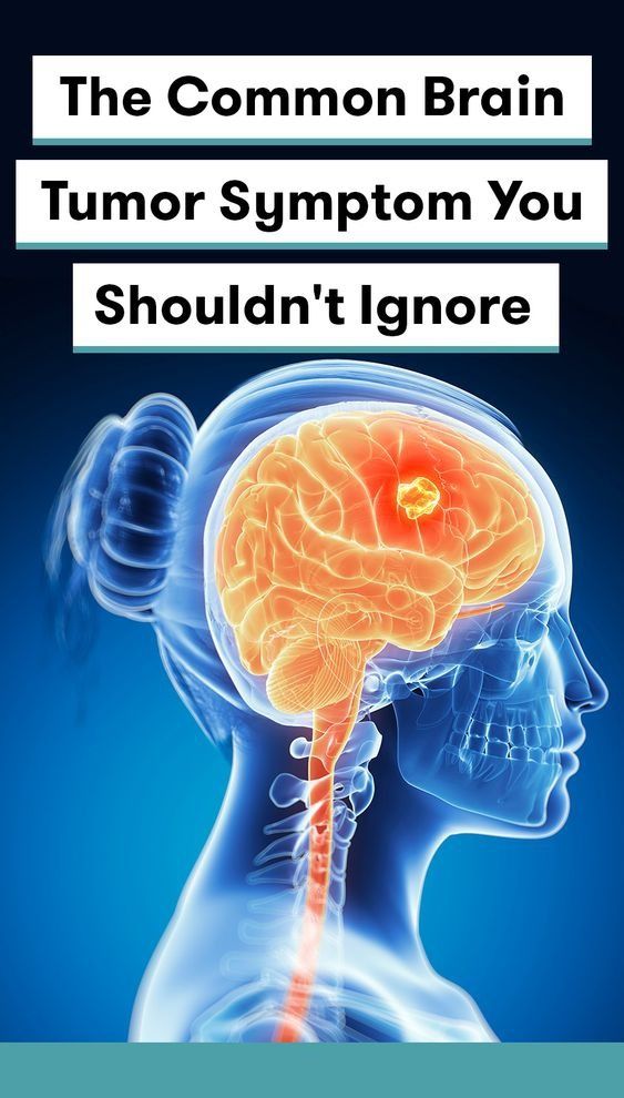 Five Brain Tumor Symptoms You Can Recognize Even Before ...
