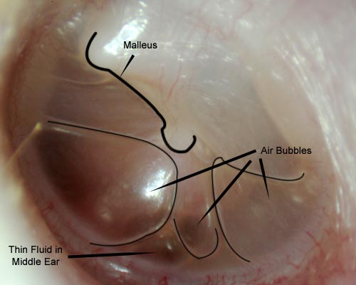 How To Clear Fluid From Middle Ear (3)