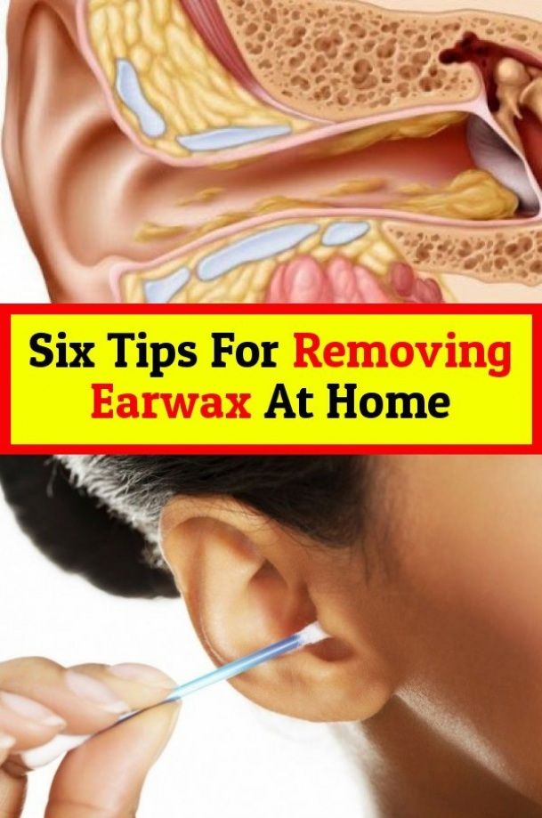 Here are six tips to remove Earwax in 2020