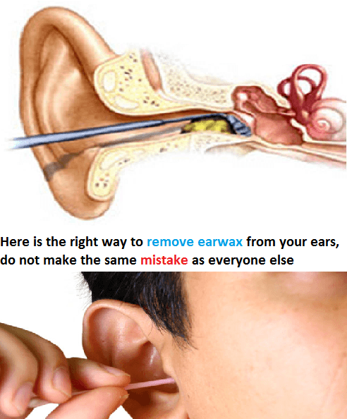 Here is the right way to remove earwax from your ears, do ...