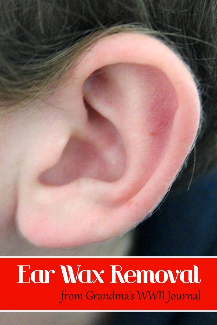 Home Remedies: Ear Wax Removal