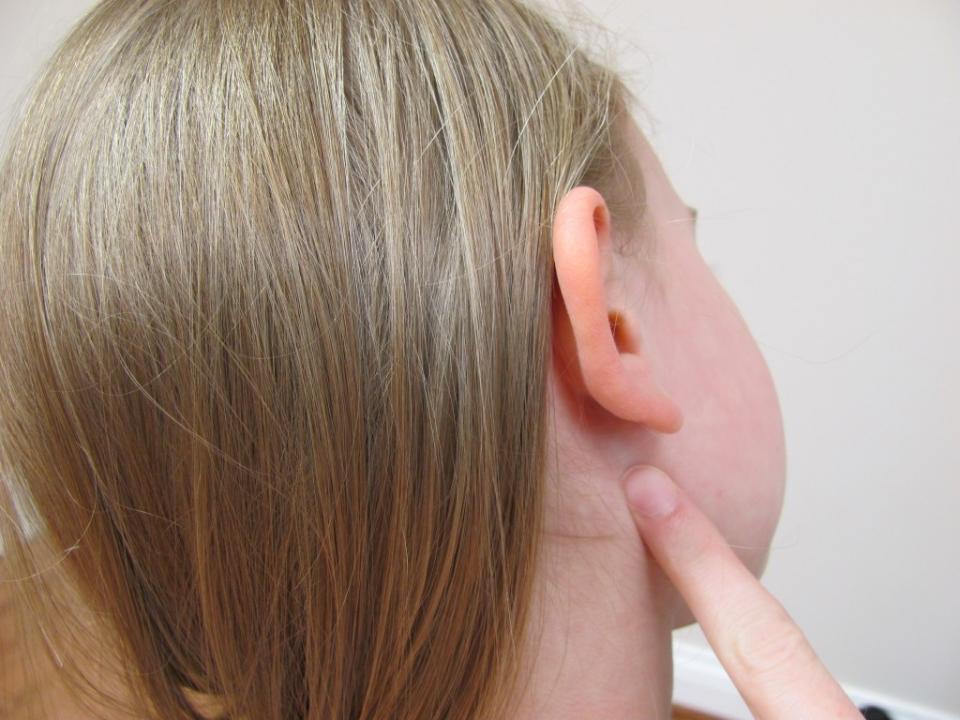 Homemade Natural Remedies For Ear Infection