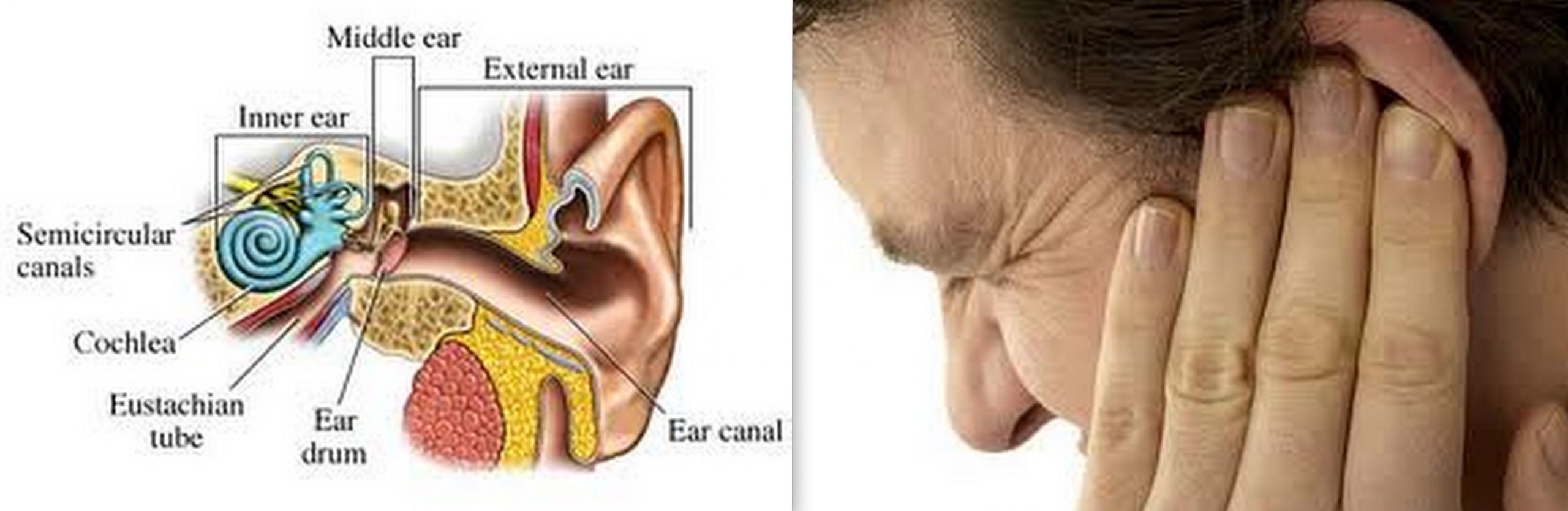 How can tinnitus be prevented? Some types of tinnitus may ...