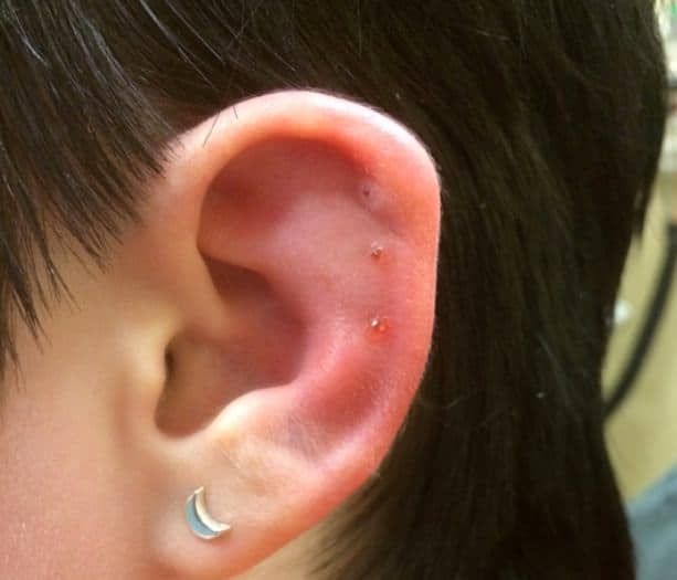 How Can You Tell If Your Ear Piercing Is Infected