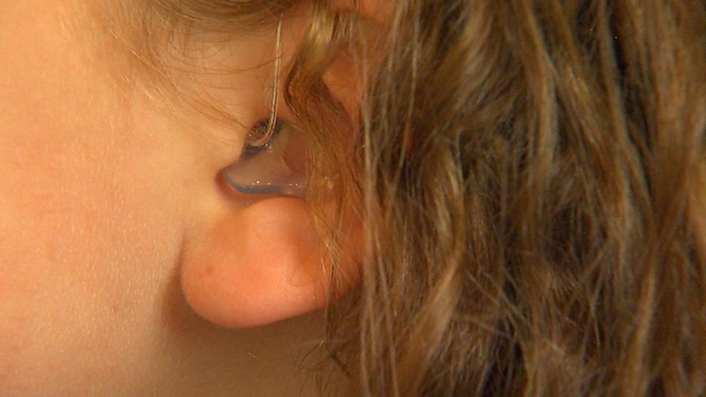 How parents are fighting to get insurance to cover hearing aids