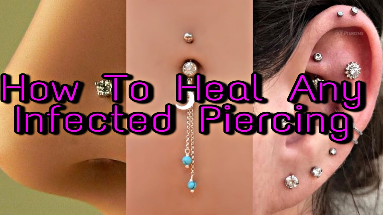 How To Clean Any Infected Piercing Fast!!