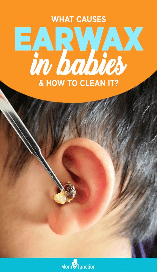 How To Clean Baby Earwax: Safety And When To See A Doctor ...