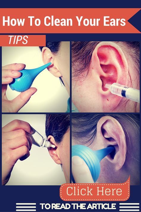 How to Clean Your Ears? Best Ways to Remove Ear Wax