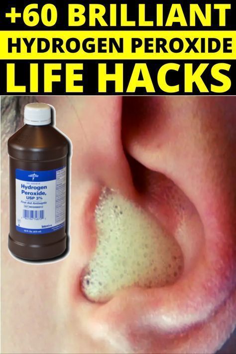 How To Clean Your Ears With Hydrogen Peroxide