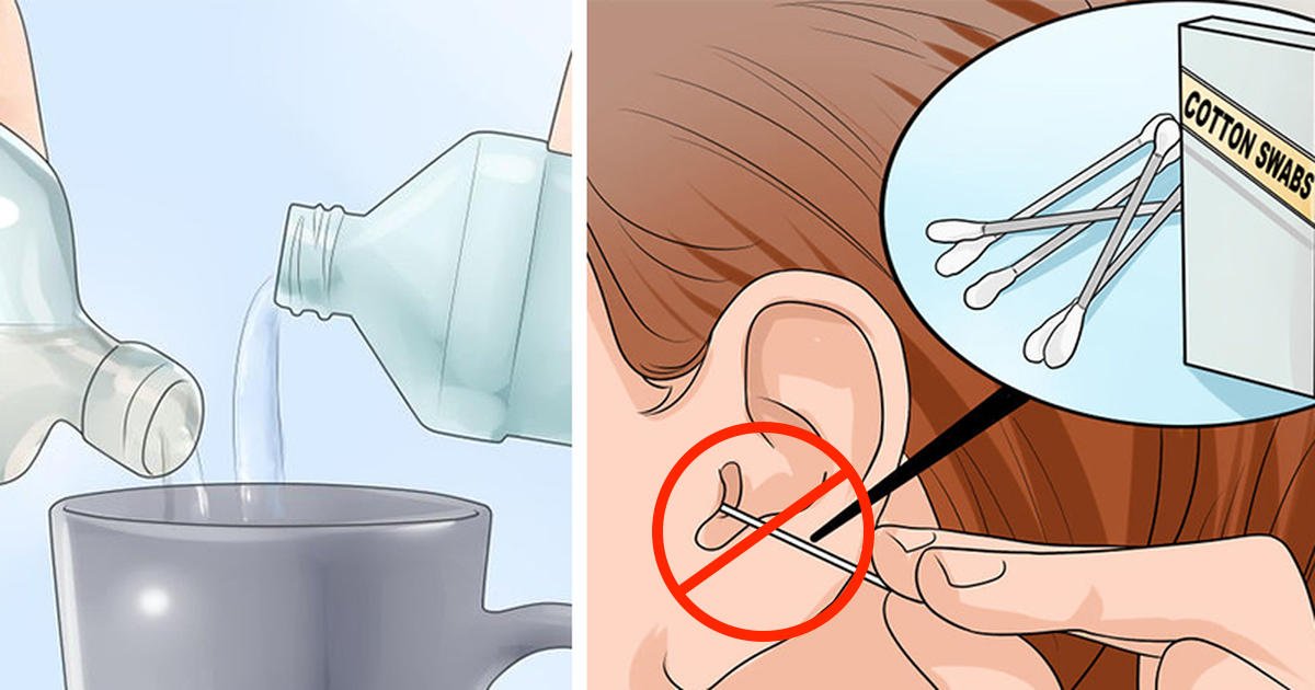How To Eliminate Earwax And Ear Infections Naturally