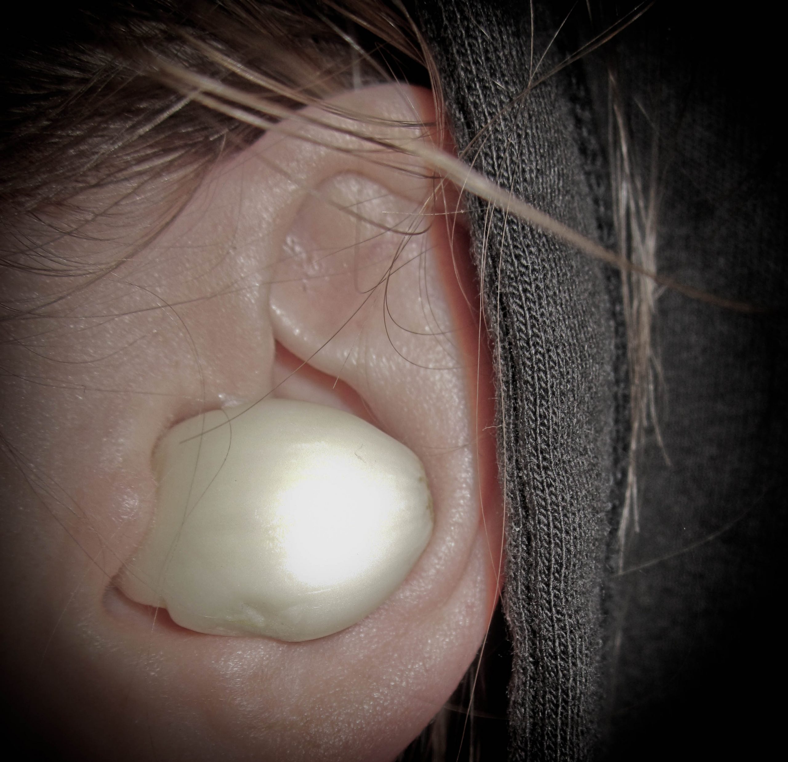 How to Get Rid of Ear Infection
