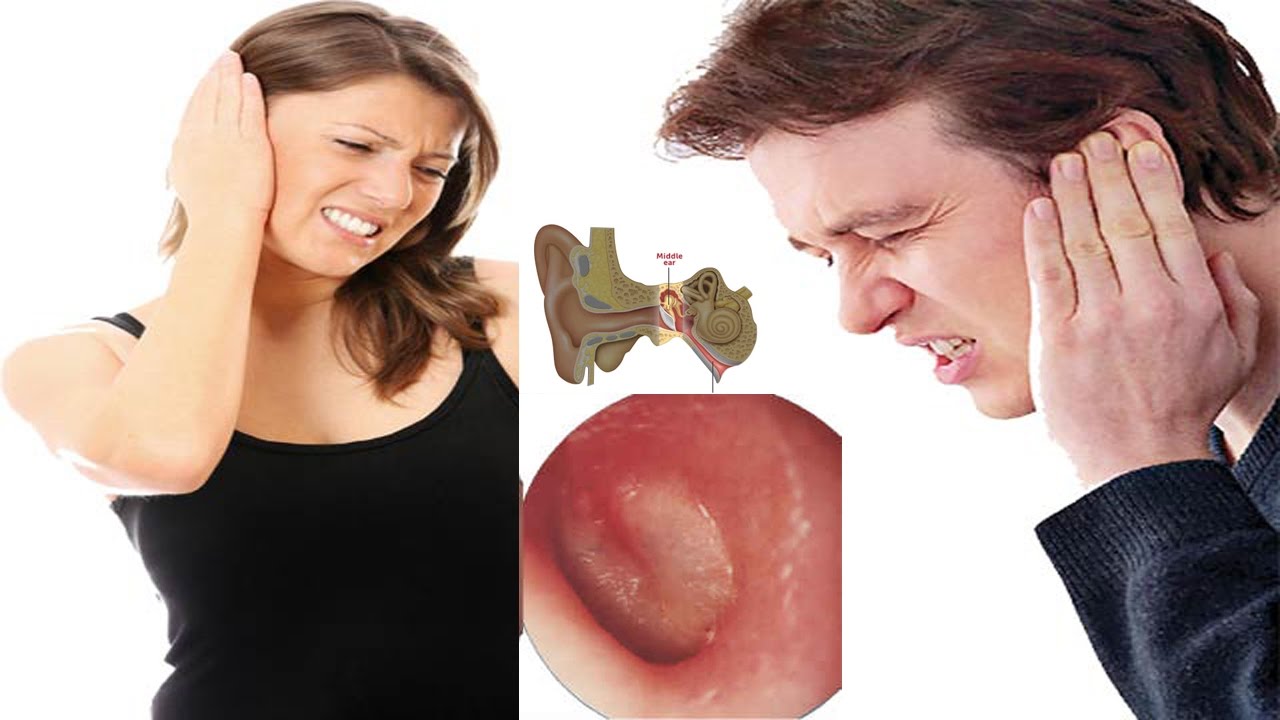How to Get Rid Of Earache Fast Naturally
