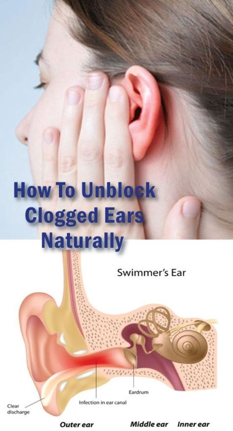 How To Unblock Clogged Ears Naturally  Home Remedies ...
