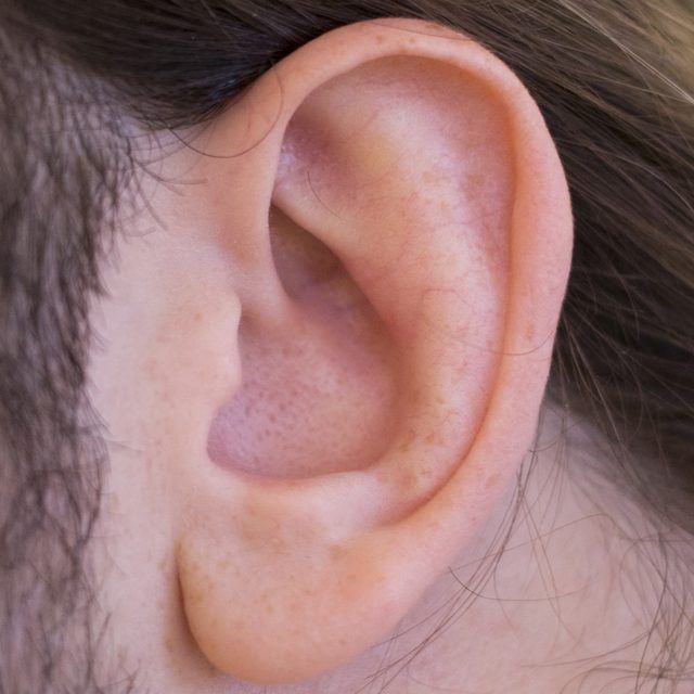 How to Unclog Ears From Congestion Naturally