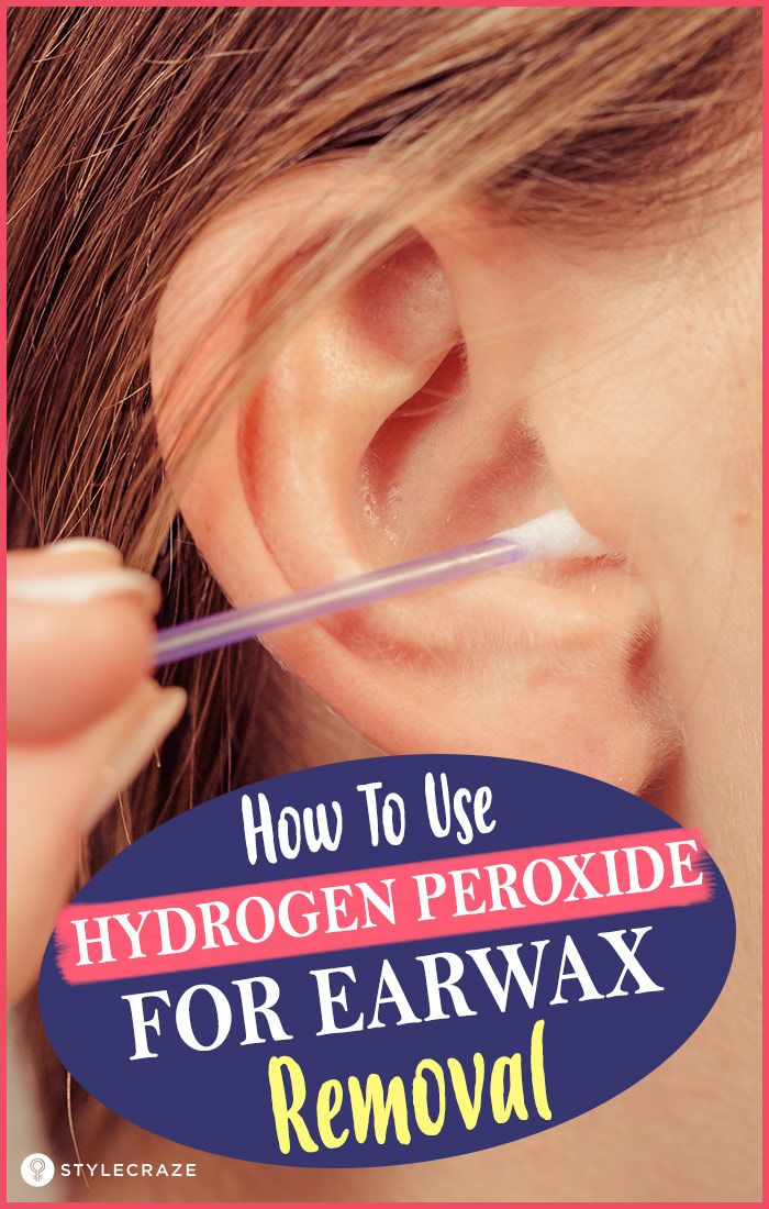 How To Use Hydrogen Peroxide For Earwax Removal