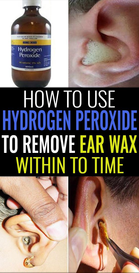 How To Use Hydrogen Peroxide To Remove Ear Wax?