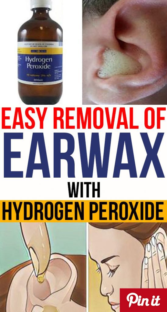 HOW TO USE HYDROGEN PEROXIDE TO REMOVE EAR WAX?
