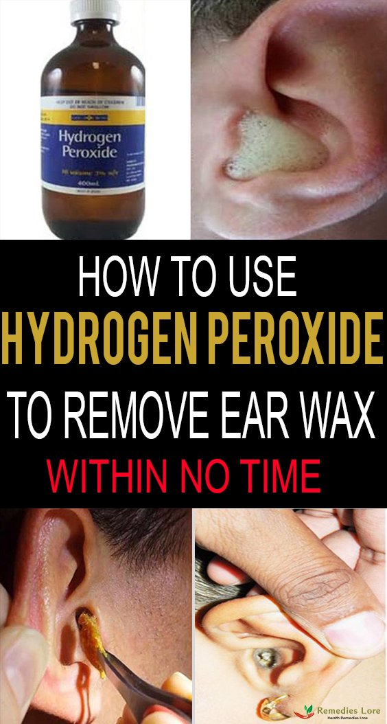 How To Use Hydrogen Peroxide To Remove Ear Wax?