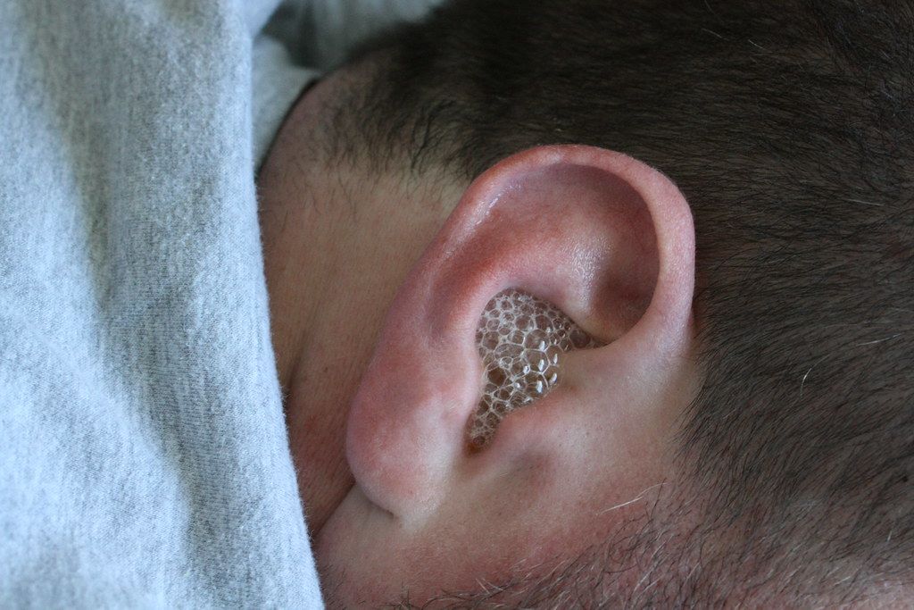 Hydrogen Peroxide Being Used in Ears