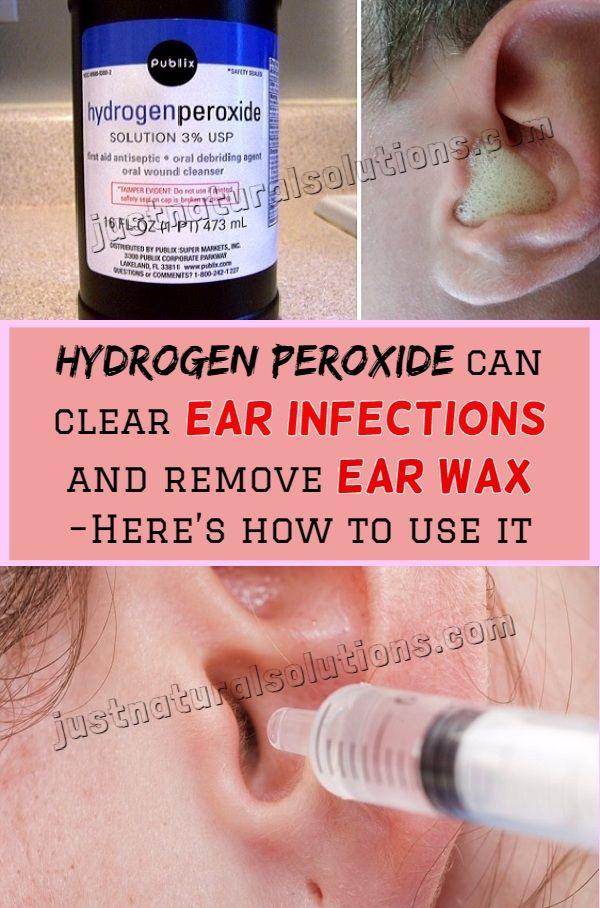 Hydrogen Peroxide can clear ear infections and remove ear wax  Heres ...