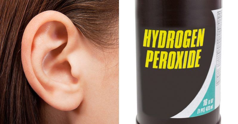 Hydrogen Peroxide Can Help Clear Ear Wax, but what about ...