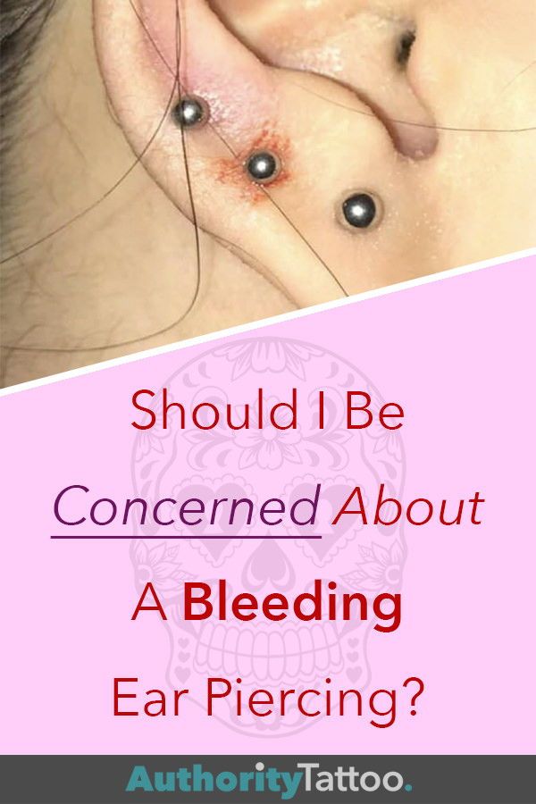 If your ear piercing is bleeding, it can be perfectly ...