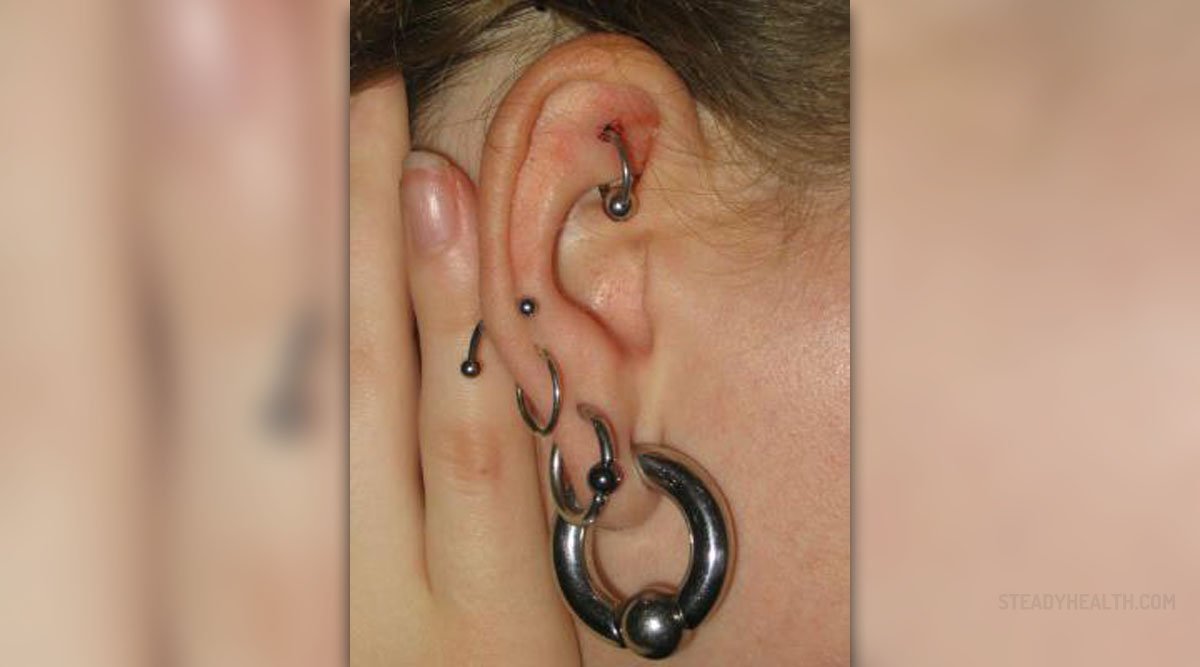 Infected ear piercing causes and symptoms