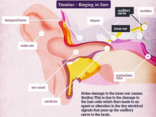 Natural Treatment for Tinnitus