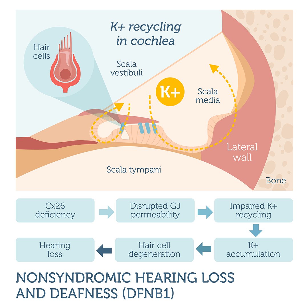 Nonsyndromic Hearing Loss and Deafness (DFNB1) DNA Test ...