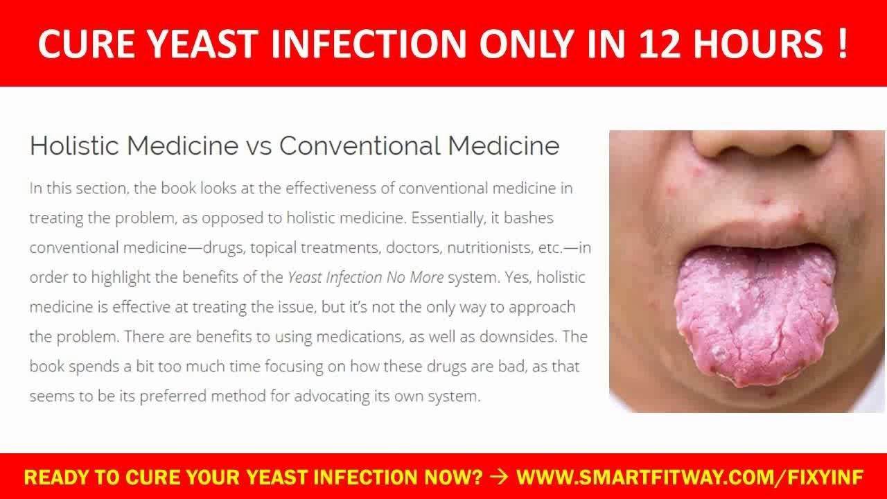 Over The Counter Medication For Yeast Infection ...