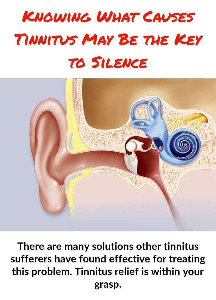 Pin by Mabel Gobbel on Tinnitus relief in 2020