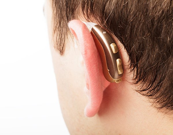 Pros and Cons of BTE Hearing Aids