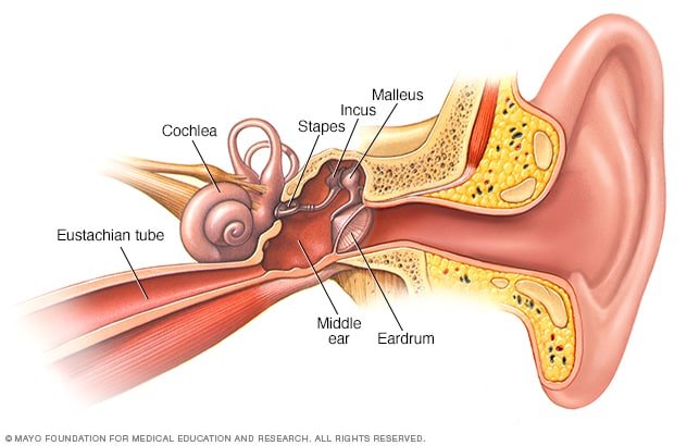 Ruptured eardrum (perforated eardrum)