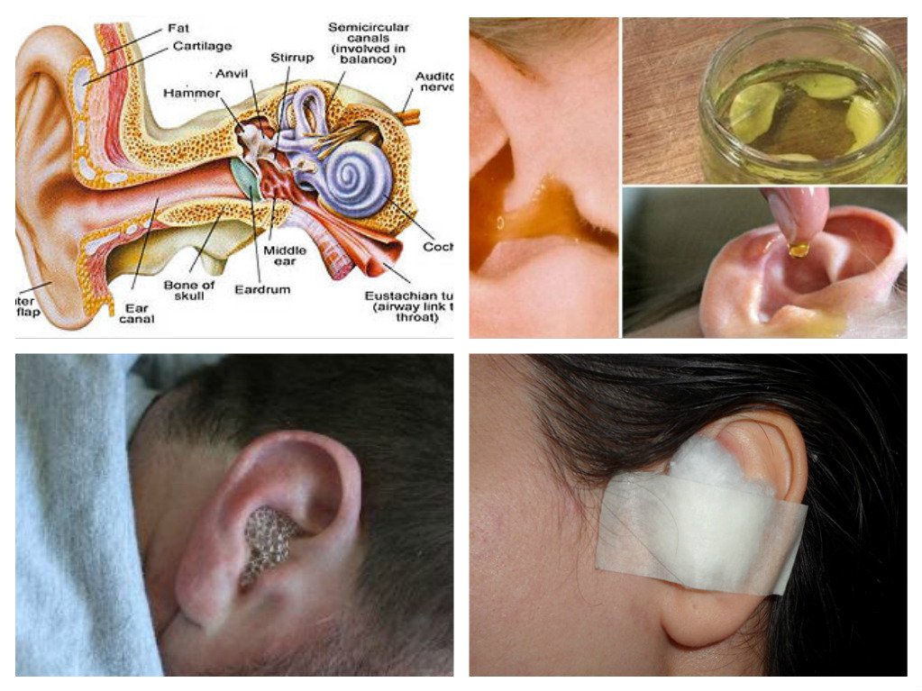 Say Goodbye To Ear Infection! Cure Ear infection In Just 1 Day 100% ...