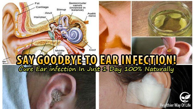 Say Goodbye To Ear Infection! Cure Ear infection In Just 1 ...