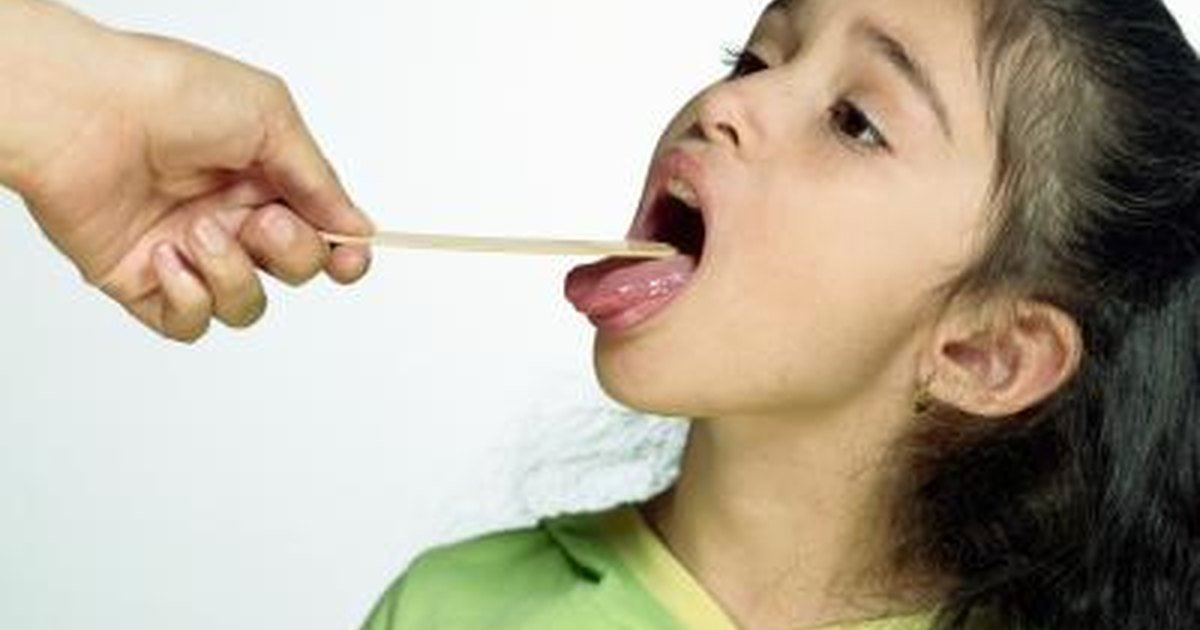 Strep Throat Symptoms Without a Fever