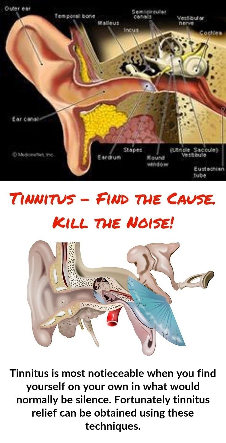There are plenty of strategies other tinnitus victims are ...