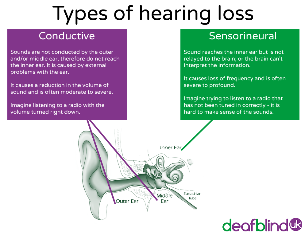 There are two main types of hearing loss, conductive and ...