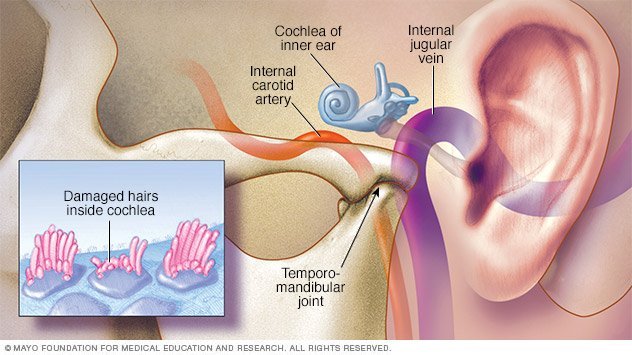 Tinnitus Disease Reference Guide