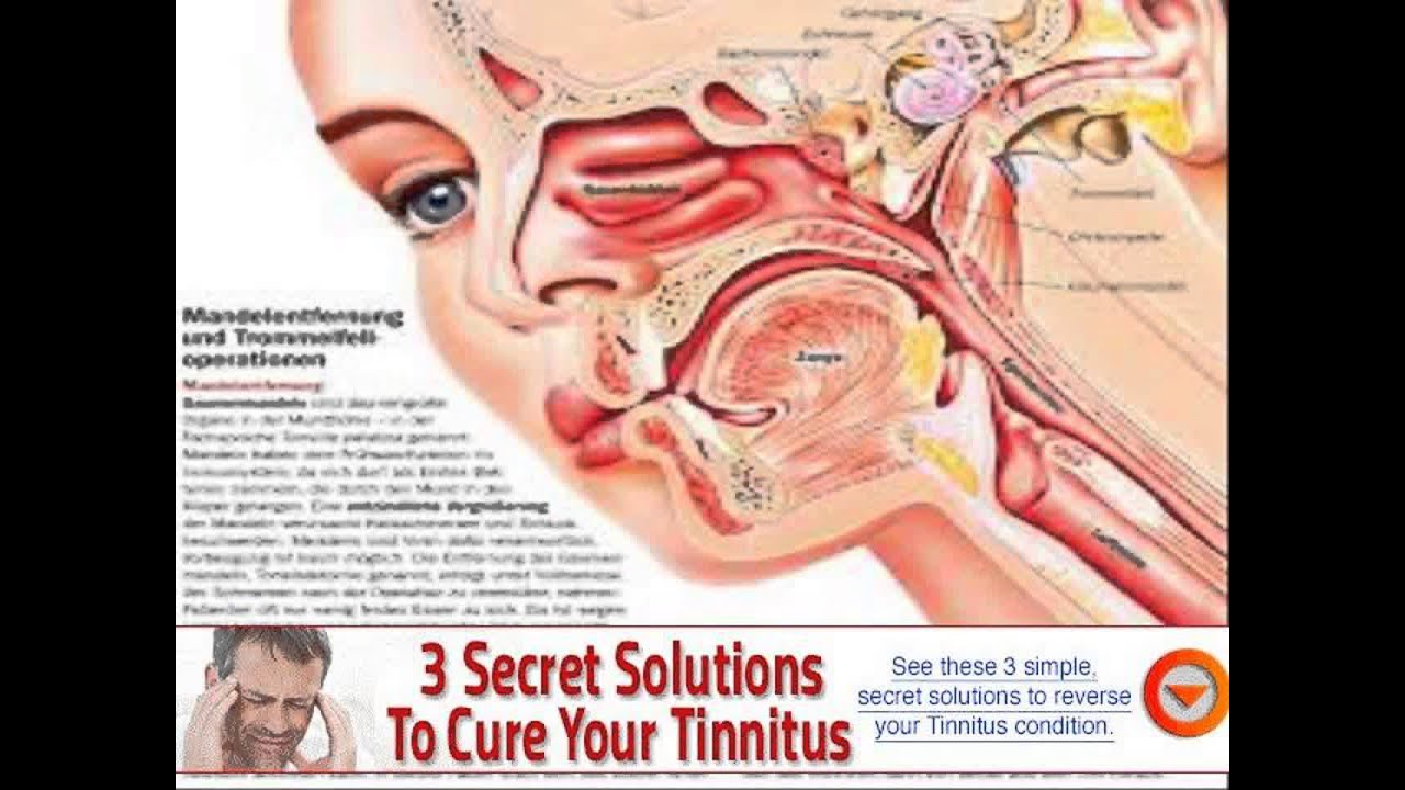 treatment for tinnitus on nhs